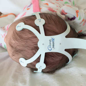 electrode array for infant EEG