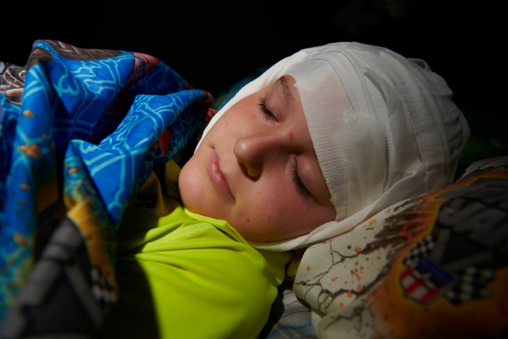 boy demonstrating how to sleep during an EEG