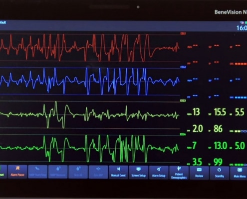 EEG on TV