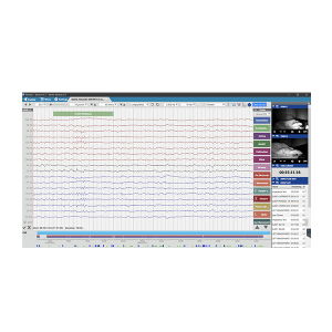 EEG software screenshot of Rendr