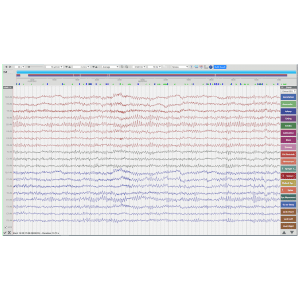 EEG software Rendr screenshot